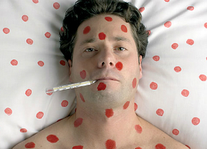 Быстрое лечение ветрянки у взрослых в домашних условиях Ветрянка у взрослых