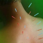 Иглоукалывание в ухо: польза и вред для похудения иглоукалывание для похудения в домашних условиях