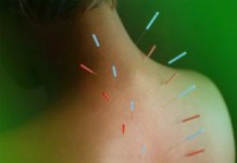 Иглоукалывание в ухо: польза и вред для похудения иглоукалывание для похудения в домашних условиях