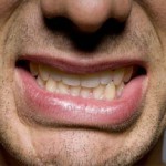 Народное лечение пародонтита в домашних условиях Что такое пародонтит?