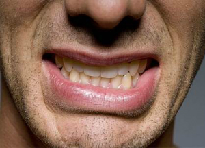 Народное лечение пародонтита в домашних условиях Что такое пародонтит?