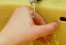 Способы лечения волдырей после ожогов в домашних условиях Холодная вода при ожоге