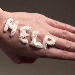 Ожог кипятком: быстрое и эффективное лечение в домашних условиях Домашние средства от ожогов кипятком