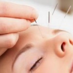 Что такое иглоукалывание: польза или вред что такое иглоукалывание и какая польза