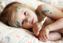 Симптомы ветрянки у детей и схема лечения в домашних условиях Ветрянка у детей