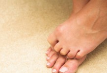 Неврома Мортона: признаки и лечение в домашних условиях Неврома Мортона