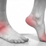 Действенное лечение суставов народными средствами в домашних условиях Лечение заболеваний суставов народными средствами