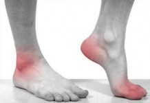 Действенное лечение суставов народными средствами в домашних условиях Лечение заболеваний суставов народными средствами