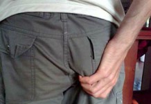 Эффективное лечение трещины заднего прохода в домашних условиях Анальная трещина