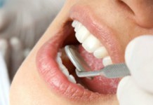 Язвочки во рту у ребенка и взрослого: лечение в домашних условиях Чем лечить язвочку во рту?