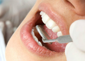 Язвочки во рту у ребенка и взрослого: лечение в домашних условиях Чем лечить язвочку во рту?