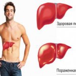 Симптомы и лечение гепатита «С» народными средствами, самостоятельно, в домашних условиях лечение гепатита с народными средствами в домашних условиях