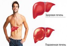 Симптомы и лечение гепатита «С» народными средствами, самостоятельно, в домашних условиях лечение гепатита с народными средствами в домашних условиях