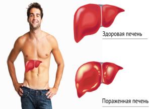 Симптомы и лечение гепатита «С» народными средствами, самостоятельно, в домашних условиях лечение гепатита с народными средствами в домашних условиях