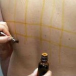 С какого возраста можно делать йодовую сетку — целебные свойства простых линий йодовая сетка целебные свойства простых линий