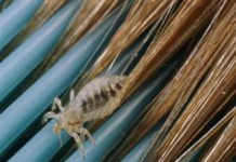 Как вывести вшей и гнид народными средствами в домашних условиях у детей и взрослых народные средства от вшей