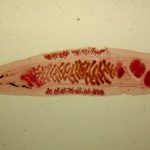 Описторхоз и что нужно знать о нем