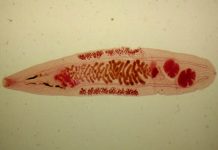 Описторхоз и что нужно знать о нем