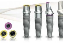 ПРЕИМУЩЕСТВА ИМПЛАНТАТОВ НОБЕЛЬ.