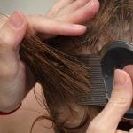 Народные средства от вшей