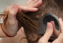 Народные средства от вшей