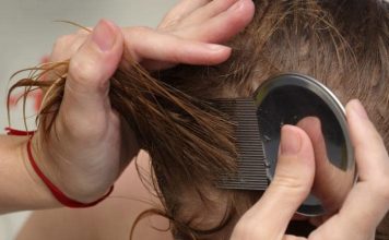 Народные средства от вшей