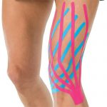 КИНЕЗИО ТЕЙПЫ