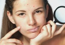 Как избавится от прыщей