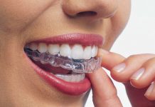 Исправление прикуса без пластинок и брекетов