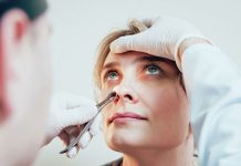 Искривление носовой перегородки