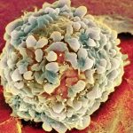 Рак становится «моложе»: действительно ли эта спорная новость способна вселять надежду