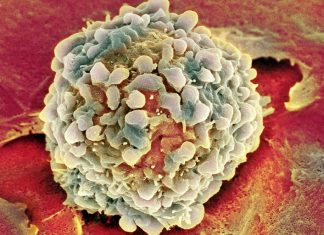 Рак становится «моложе»: действительно ли эта спорная новость способна вселять надежду