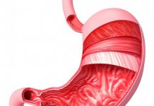 Гастрит атрофический диагностика