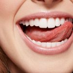 Имплантация зубов: что это такое