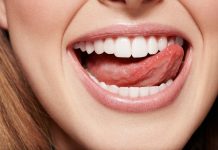 Имплантация зубов: что это такое