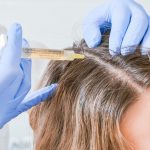 Мезотерапия: процедура для здоровья и красоты волос
