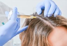 Мезотерапия: процедура для здоровья и красоты волос
