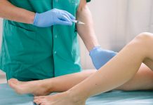 Лечение варикозной болезни методом радиочастотной абляции