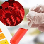 Гемоспермия или что означает кровь в сперме