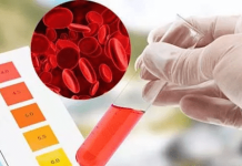 Гемоспермия или что означает кровь в сперме