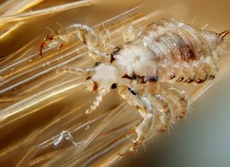 Профилактика педикулеза или как не заразиться