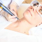 ЛАЗЕРНАЯ ХИРУРГИЯ ЛАЗЕРНАЯ ХИРУРГИЯ