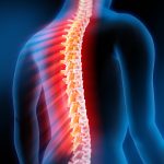 Лечение заболеваний позвоночника
