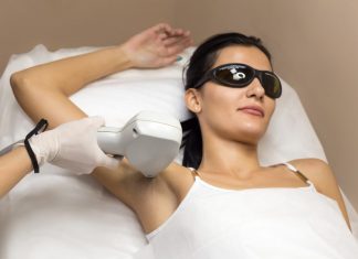 Лазерная эпиляция
