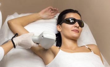 Лазерная эпиляция