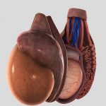 Эпидидимит: что это за болезнь и каковы причины