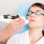 Что такое фотокоагуляция сосудов на лице