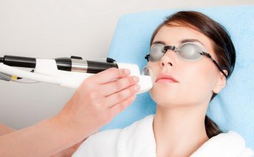 Что такое фотокоагуляция сосудов на лице