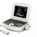 Что нужно знать про аппараты УЗИ