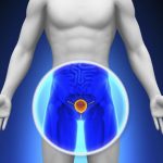 Простатит: что за болезнь и как лечить